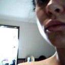 next day after treatment